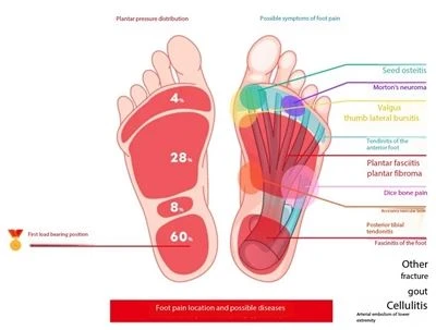 The Best Shoes For Relieving Foot Pain